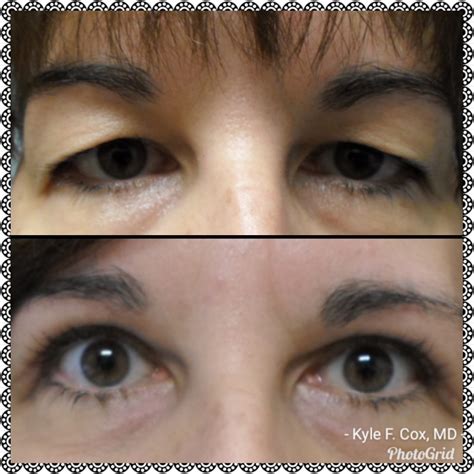 Tomoka eye - Karin Schoeler, O.D. Board Certified: American Board of Optometry Undergraduate School: Delaware Valley College, Philadelphia, PA Pennsylvania College of Optometry ...